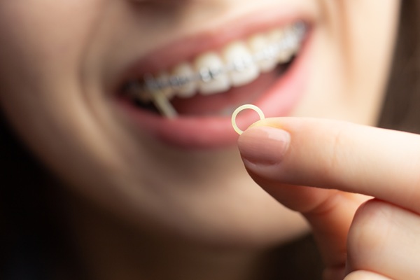 Wearing Bands On Your Braces