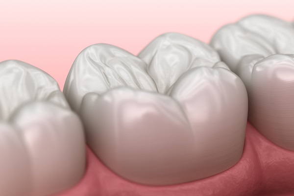 What To Know About Dental Filling Material Options