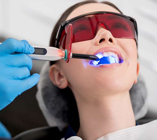Santa Ana Professional Teeth Whitening